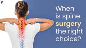 Spine-Surgery