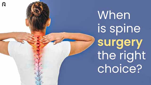 When is Spine Surgery the Right Choice?